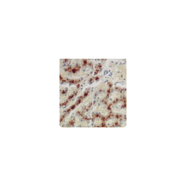 Copper Stain Kit (For Microwave)